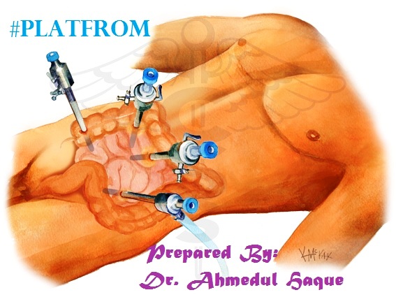 laparoscopic-surgery