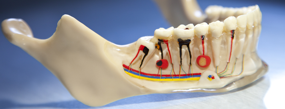 Dental Endo Laser Course ,Hands on exam