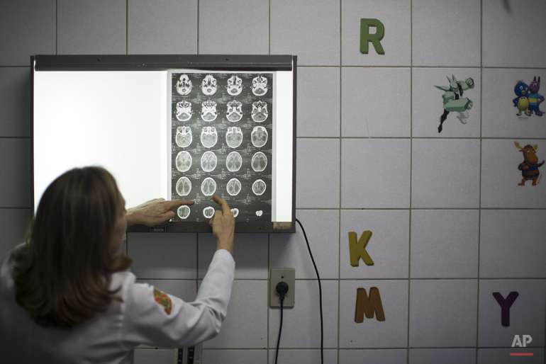 Doctor Angela Rocha shows brain scans of a baby born with microcephaly at the Oswaldo Cruz Hospital in Recife, Brazil, Thursday, Jan. 28, 2016. Brazilian officials still say they believe there's a sharp increase in cases of microcephaly and strongly suspect the Zika virus, which first appeared in the country last year, is to blame. The concern is strong enough that the U.S. Centers for Disease Control and Prevention this month warned pregnant women to reconsider visits to areas where Zika is present. (AP Photo/Felipe Dana)
