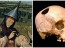 ancient-trepanation-1