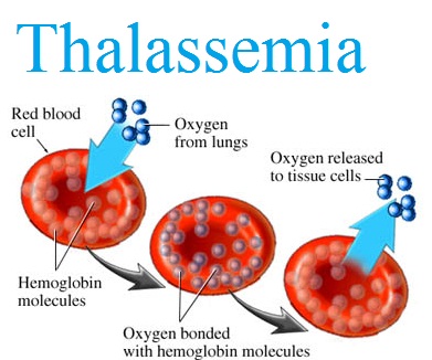থ্যালাসেমিয়া-বংশগত রোগ,জানুন ও সচেতন হোন