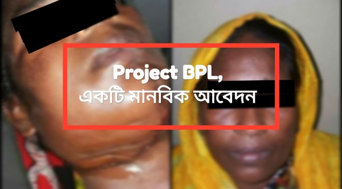 বিনামূল্যে মুখের ক্যান্সারের চিকিৎসা পেলেন দরিদ্র রোগী : “Project BPL”