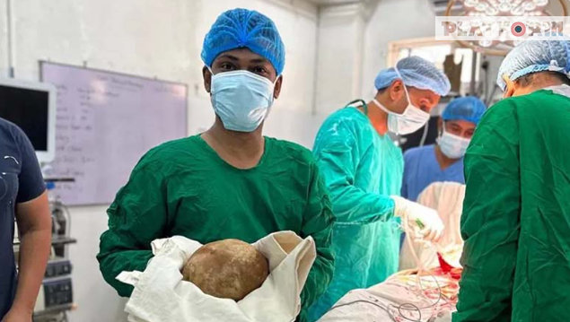 শ্রীলঙ্কায় ৩.১ কেজি ওজনের মূত্রথলীর পাথর অপসারণ, বিশ্বরেকর্ড এর দাবী চিকিৎসকদের